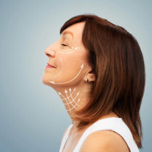 شد الوجه (Facelift)